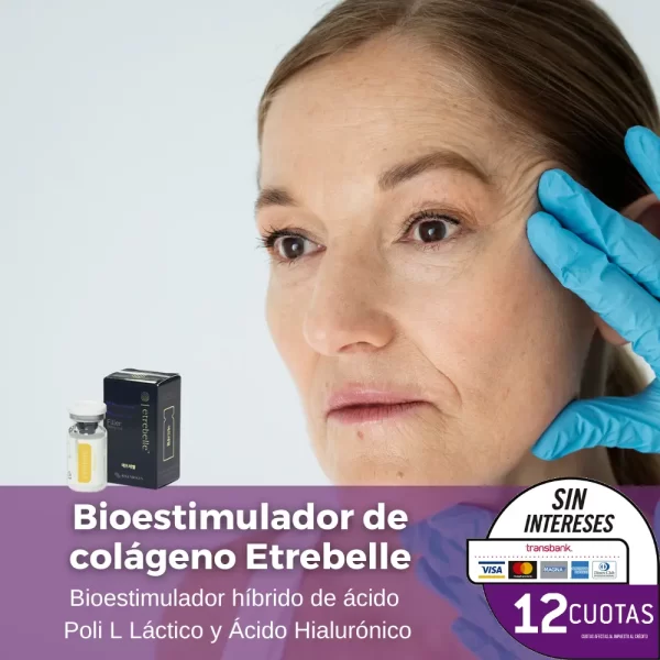 Bioestimulador Etrebelle