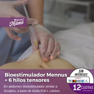 Bioestimulador Mennus + 6 hilos tensores (en abdomen)