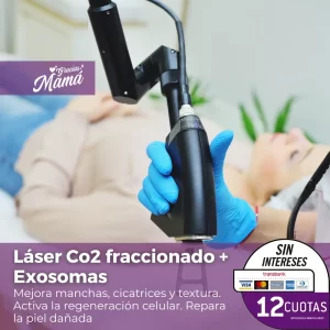 Láser Co2 fraccionado + Exosomas (1 sesión)
