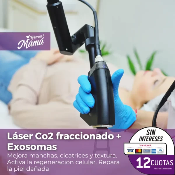 Láser Co2 fraccionado + Exosomas (1 sesión)