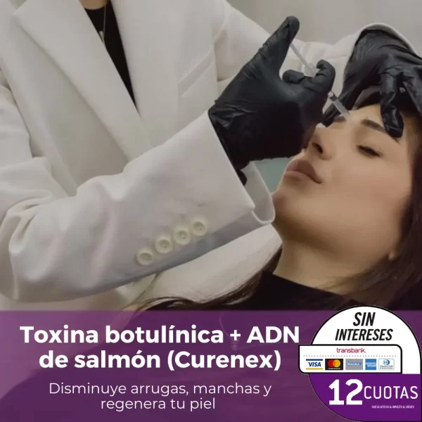 Toxina botulínica 3 zonas + una sesión de ADN de Salmón