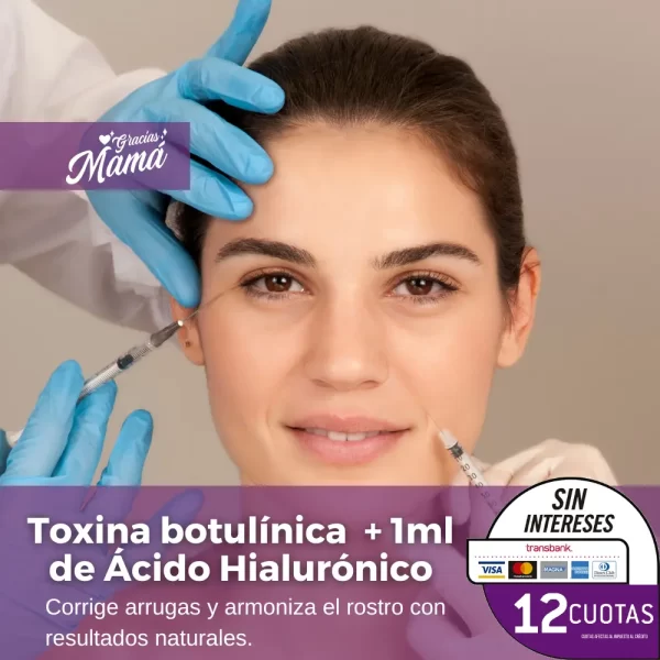 Toxina botulínica + 1ml de Ácido Hialurónico