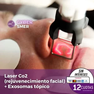 Láser CO2 Fraccionado + Exosomas