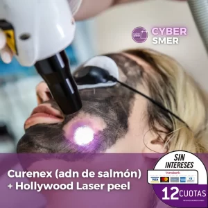 Curenex (ADN de salmón)  + Hollywood Láser Peel