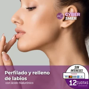 Relleno de Labios con ácido hialurónico