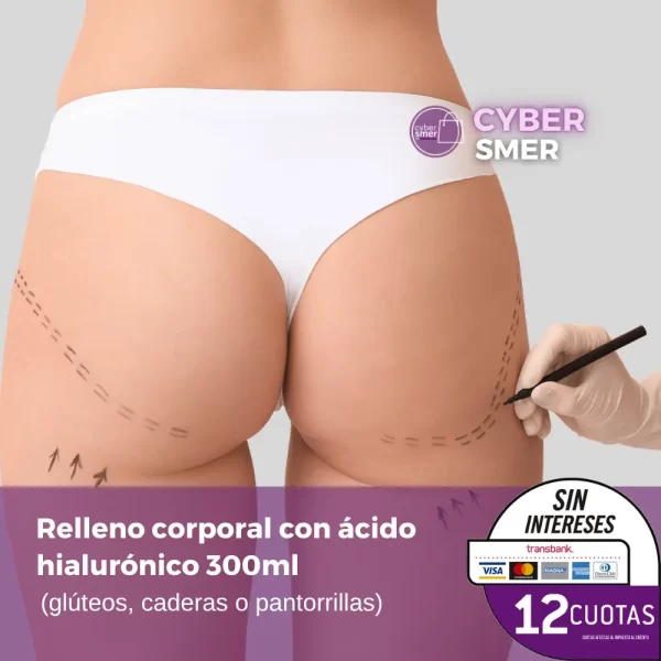 Relleno corporal con ácido hialurónico