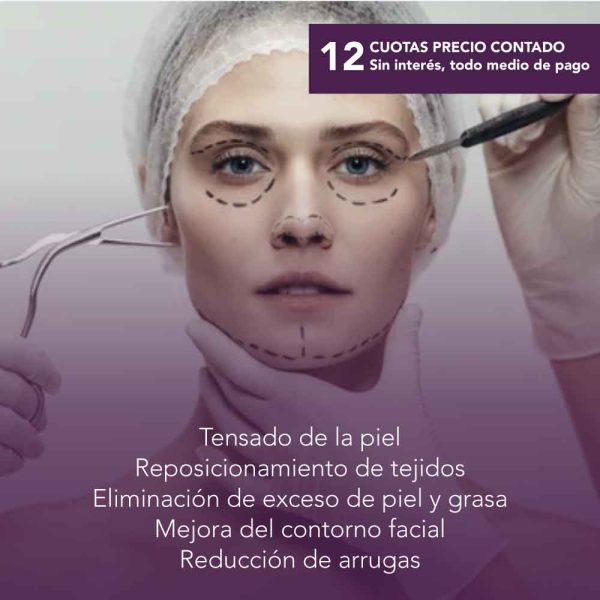 Lifting facial quirúrgico rostro completo + 5 sesiones de drenaje linfático