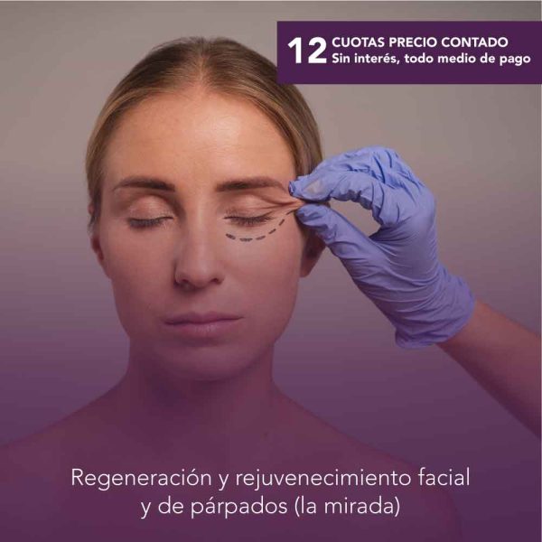El Láser Fraccionado de CO2 + Blefaroplastia