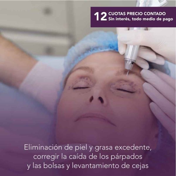 Blefaroplastia (cirugía de párpados) +  Brow Lift